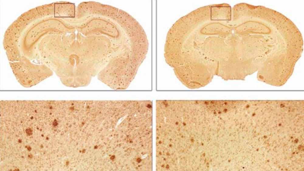 Mice-Alzheimer's-symptoms-reversed-1-week-protein-injection