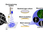 Futuristic band aid entices the bacteria in your wound to grow in the bandage peel off the germs