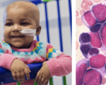 Genetically engineered designer cells used to reverse baby girl's cancer