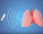 Video ingestible tiny sensor can easily measure heart and respiratory rate