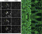 Research teams use crispr successfully snip muscular dystrophy away