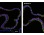 Novel technique enables researchers grow fallopian tubes advances potential treatments reproductive disorders