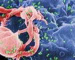 Crispr cas9 eradicate hiv genomes advancement help cure aids