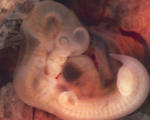 Nih ease restrictions genetic engineering chimera embryos part human animal