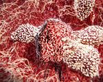 Discovery of new t cell raises prospect of universal cancer therapy